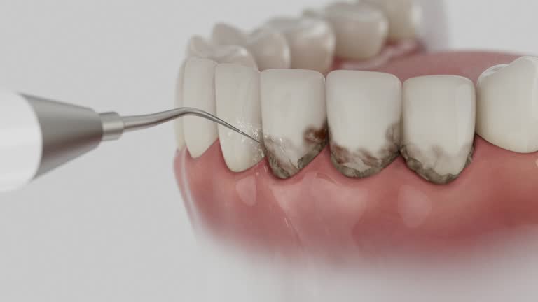 Reliable Emergency Dentist contractor in McKenzie, TN by Smile Center Dentistry